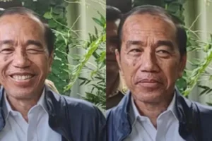 Penyakit Kulit Jokowi Jadi Sorotan